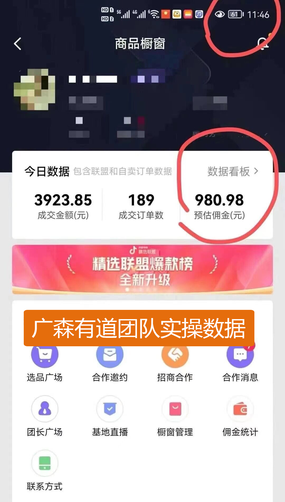 单号日收入近1000元，抖音好物带货，就是细节很重要-钟振森短视频带货创业